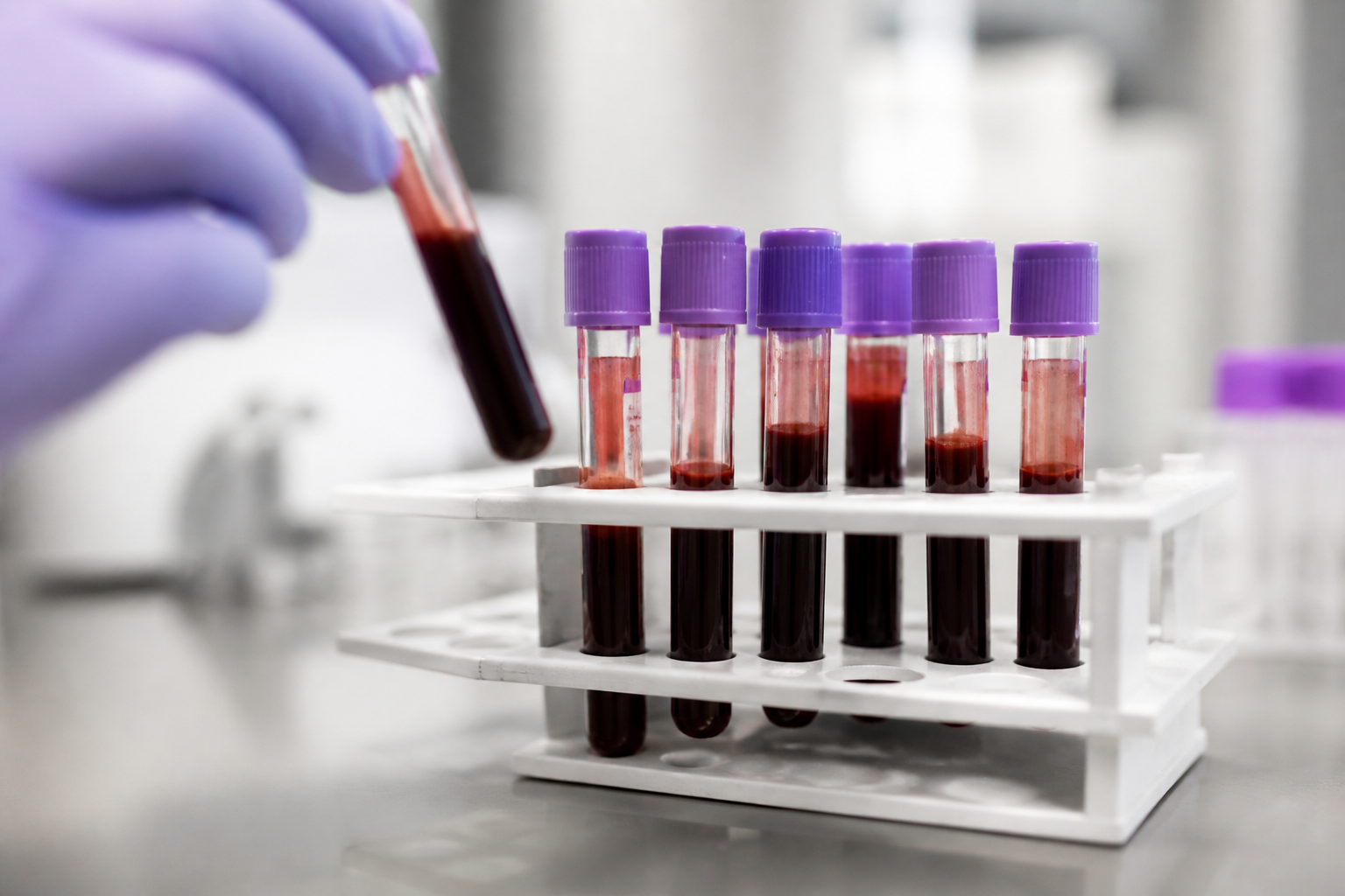 A close-up of medical test tubes filled with blood samples in a laboratory rack, focusing on the precision of nutritional diagnostic testing.