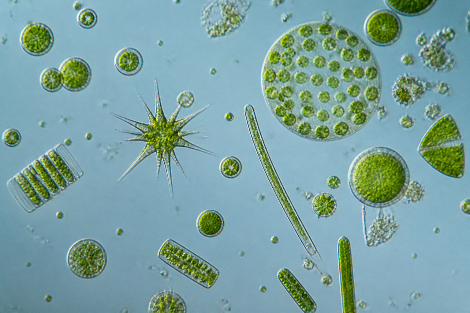 A high-contrast microscopic view of various phytoplankton species, showing intricate geometric shapes and vibrant green chlorophyll.